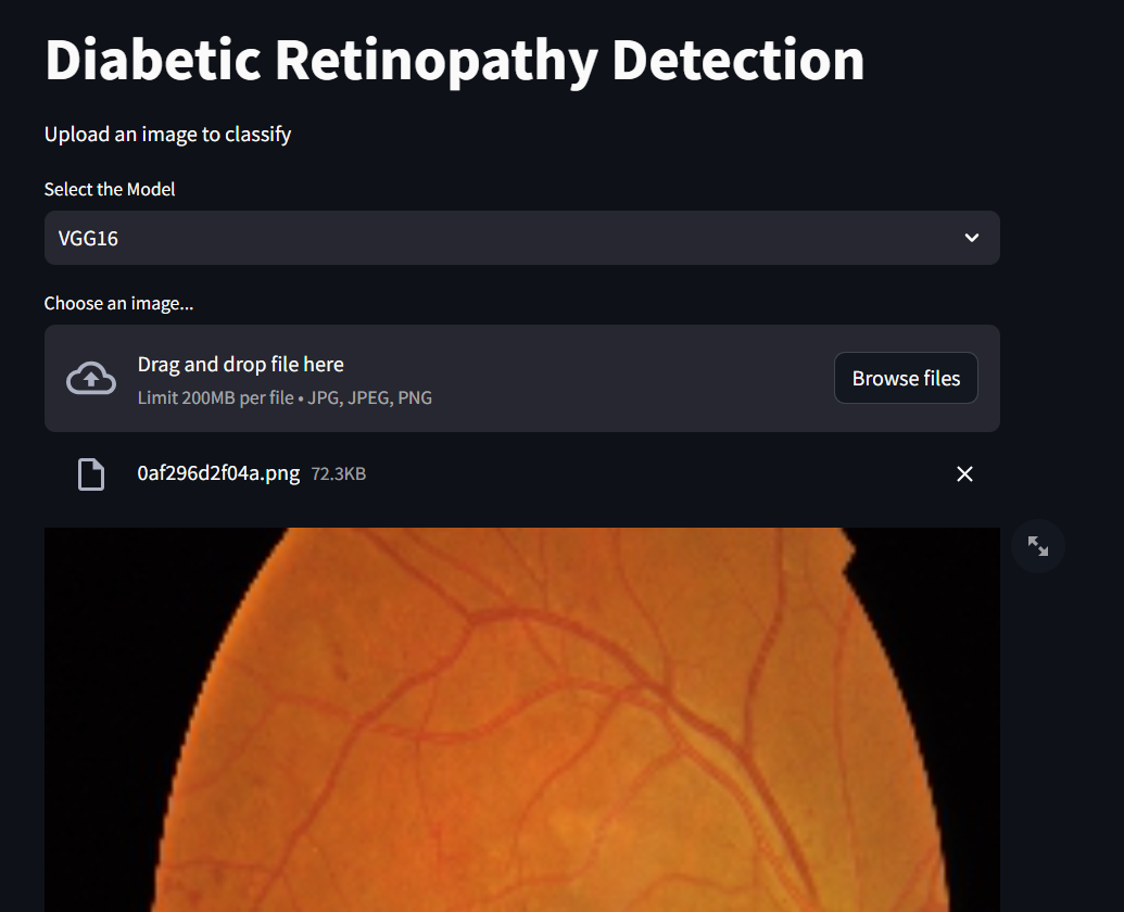 Diabetic Retinopathy Diagnosis